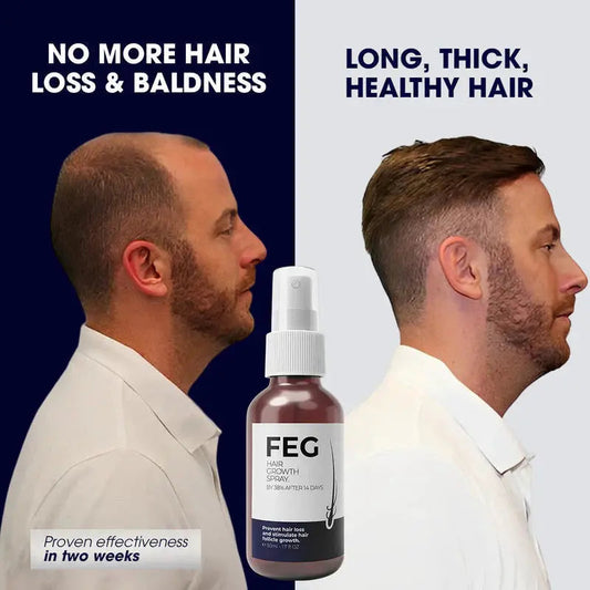 FEG Plus Hair Growth Spray ( Buy One Get One Free )