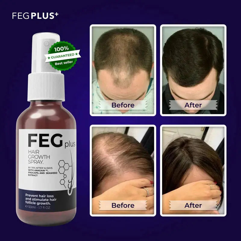 FEG Plus Hair Growth Spray  ( Buy One Get One Free )